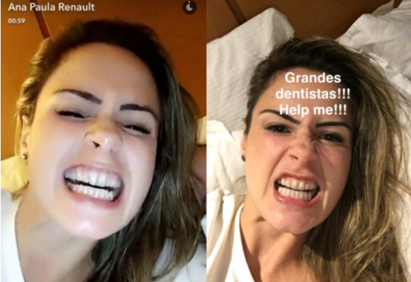 Video Ex BBB Ana Paula mostra os dentes e pede tratamento odontológico na web Quero dos bons